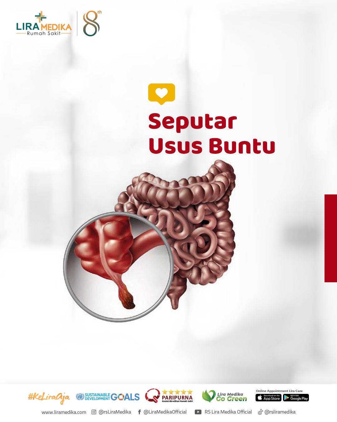Seputar Penyakit Usus Buntu